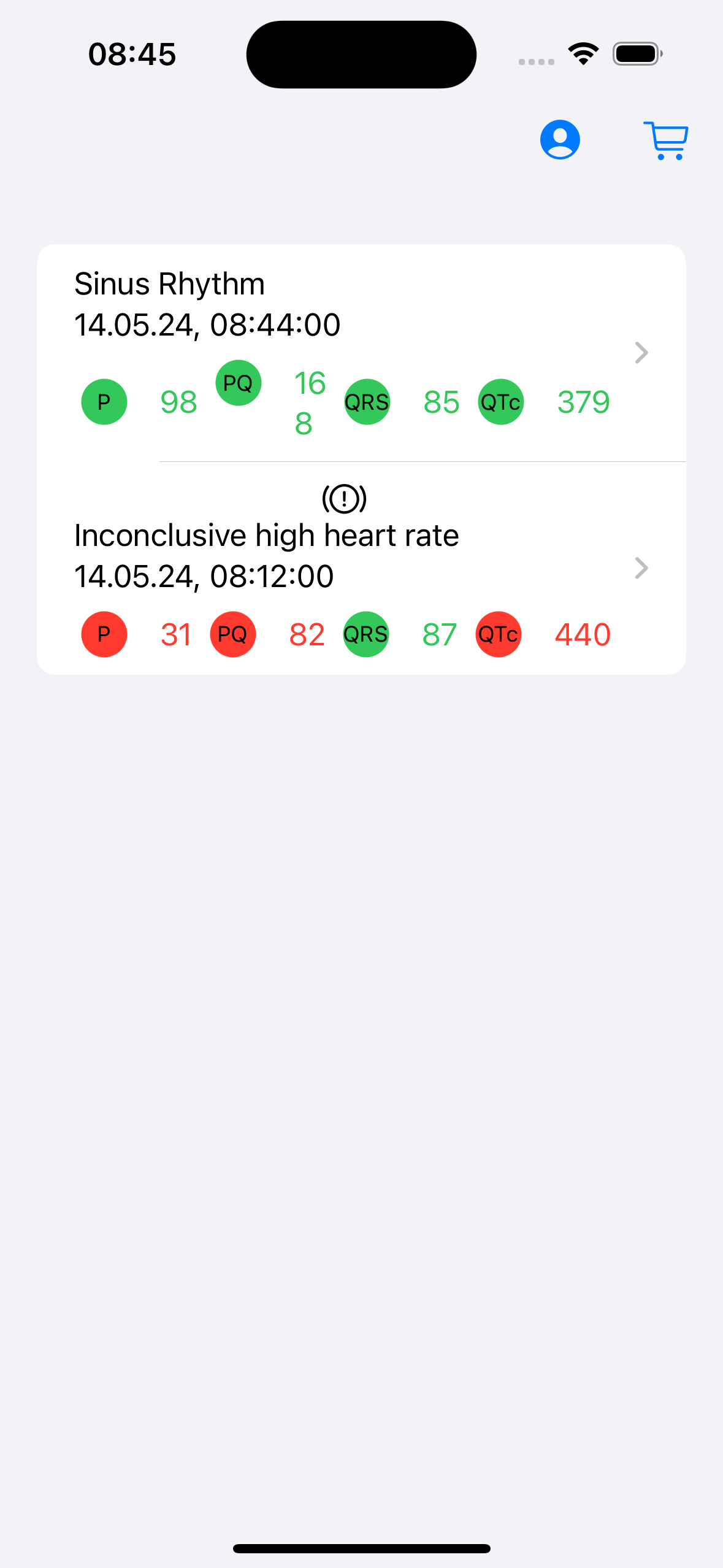 ECG AI App - Detailed ECG Wave Analysis with P, QRS, and QT Intervals
